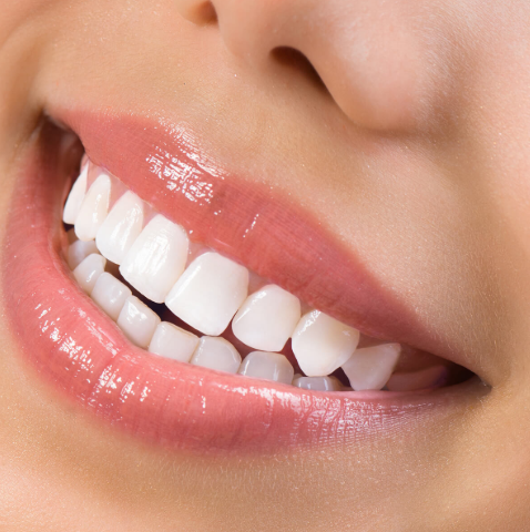 Dental Veneers London Ontario: Are They the Right Choice for Your Smile Goals?