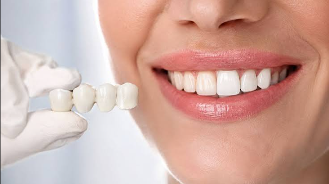 Why Previous Tooth Length Can Guide Cosmetic Dental Reconstruction